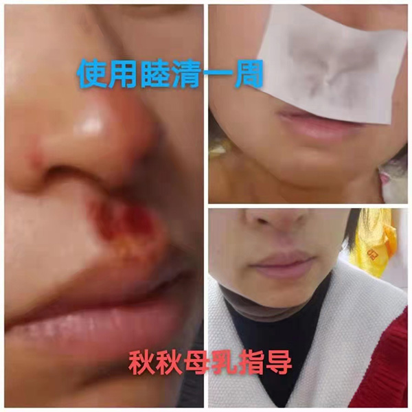 �����澏���N���Æ������M(f��i)�߿ڱ���������(sh��)���a(ch��n)ƷȦ�۟o(w��)��(sh��)